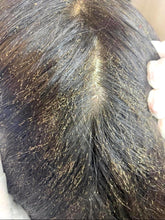 Load image into Gallery viewer, LICE REMOVAL KIT