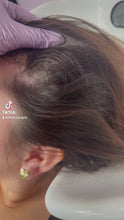 Load and play video in Gallery viewer, DANDRUFF TREATMENT
